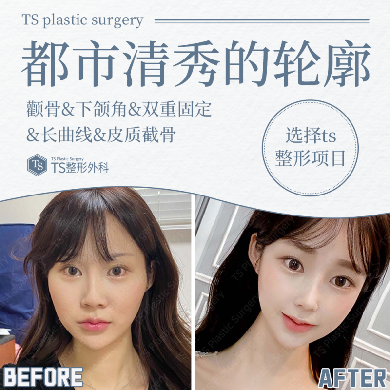 珠海中健速医美整形医院收费价格表/收费标准