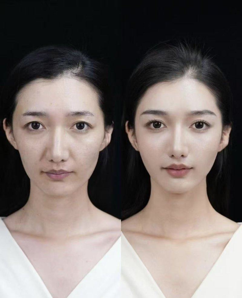 防城港品尚医疗美容诊所特色项目及技术优势