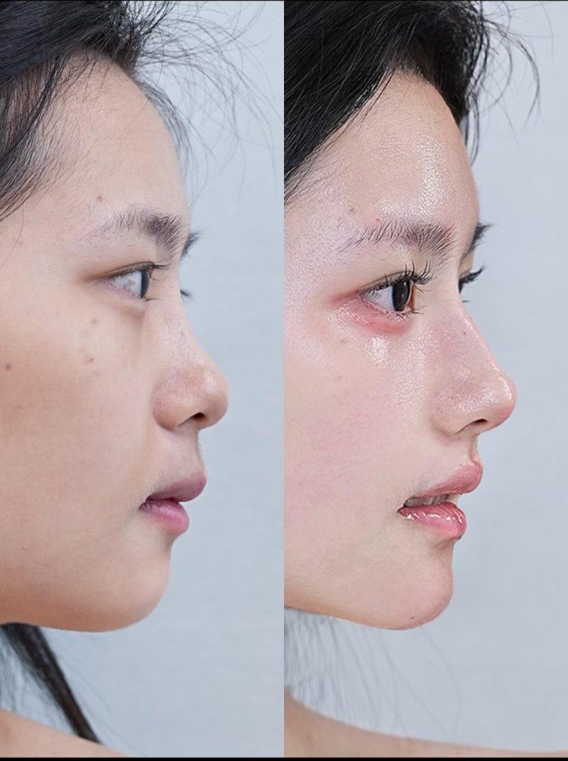 西宁柏晔医疗美容门诊部详细的预约挂号方式及流程