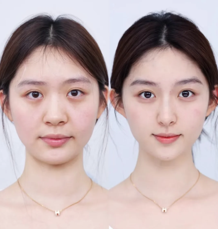 广州军区空军后勤部整形美容中 心是正规医院吗？