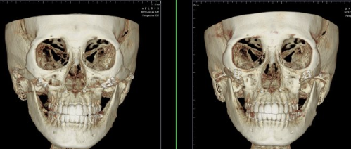 防城港品尚医疗美容诊所是正规医院吗?
