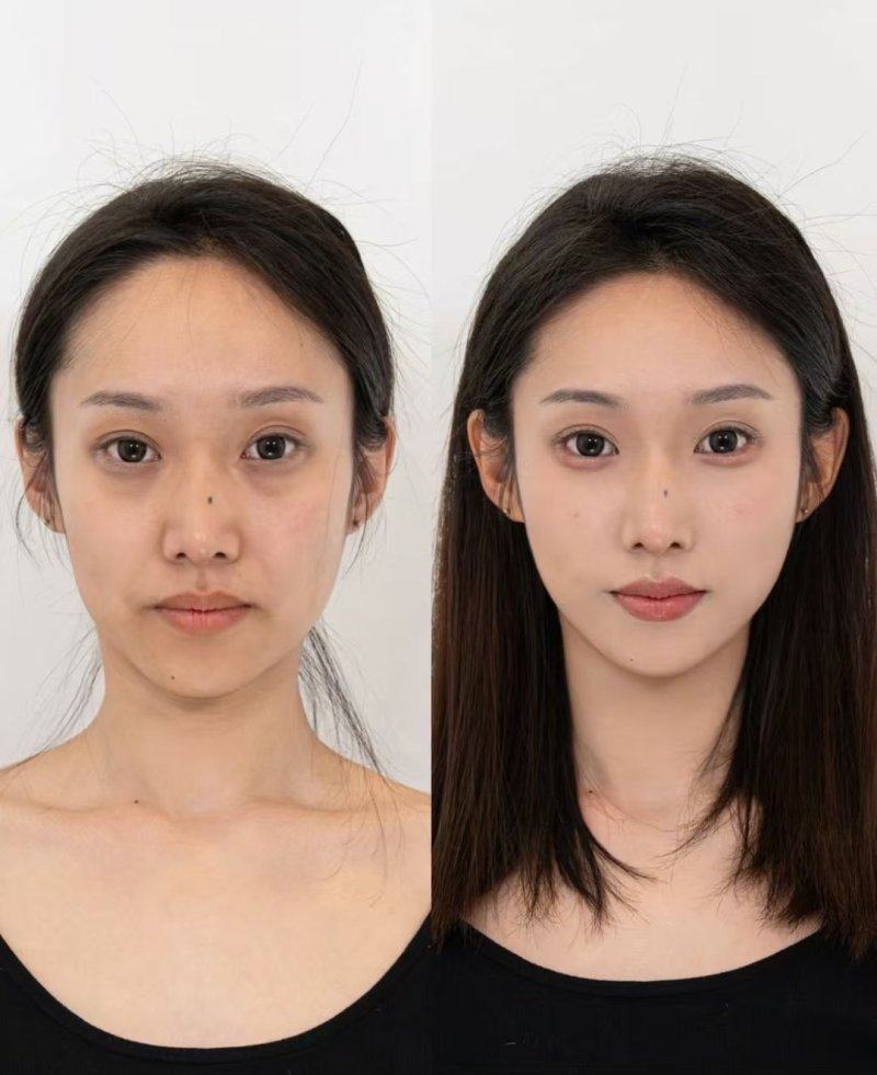 广州皙肤佳整形医院详细的预约挂号方式及流程