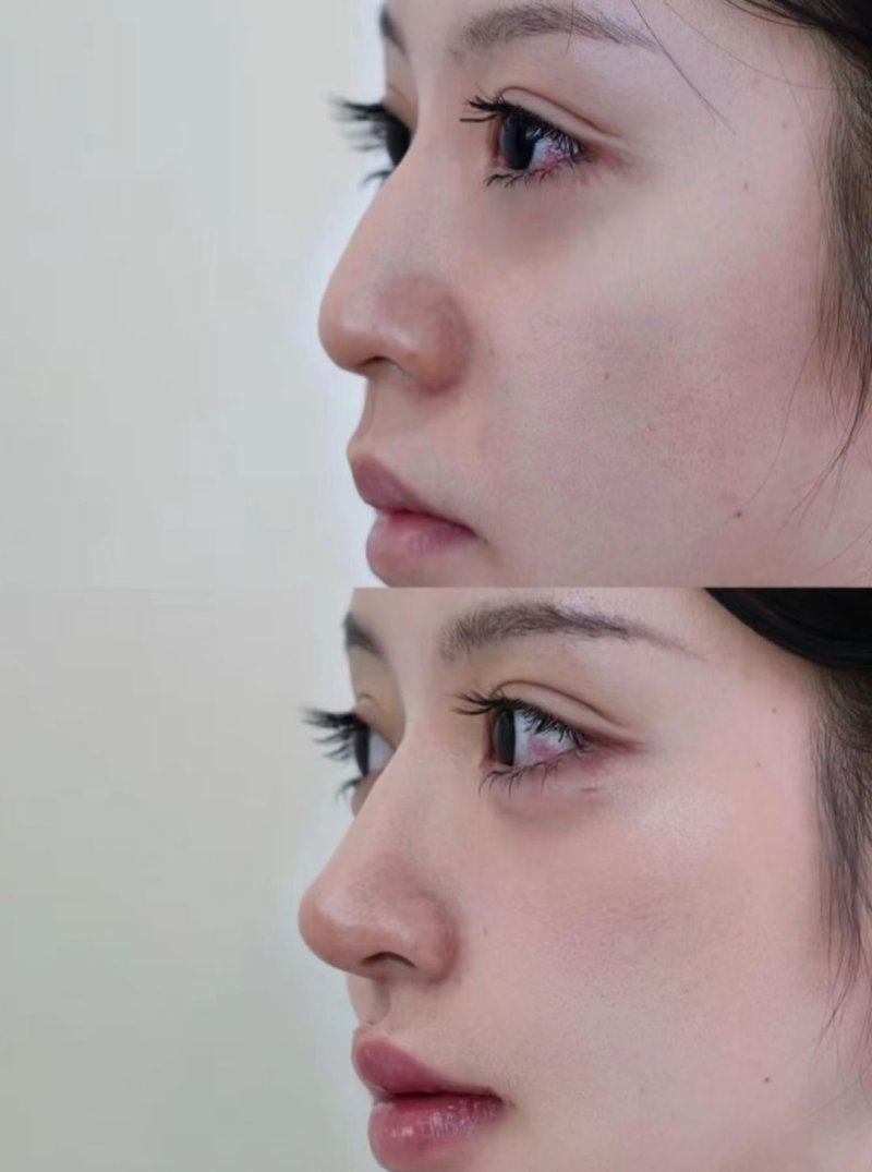 广州军区空军后勤部整形美容中 心收费价格表/收费标准