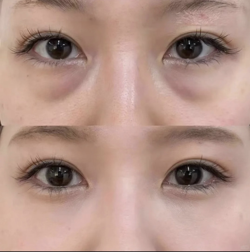 西宁柏晔医疗美容门诊部特色项目及技术优势