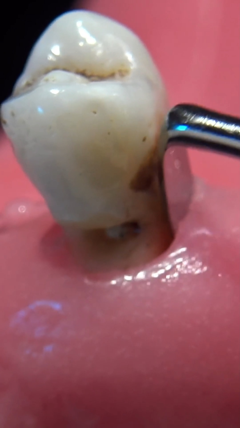 大同金冠口腔门诊部地址电话营业时间