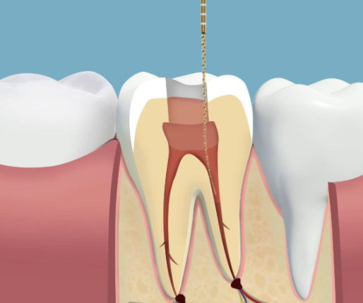 山东德州宁津康尔乐口腔真人口碑评价怎么样？