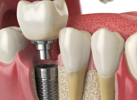 山东德州宁津康尔乐口腔是正规医院吗？