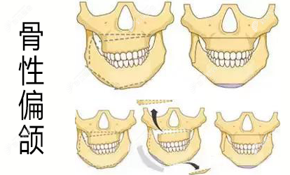 扬中曼陀罗医疗美容诊所是正规医院吗？