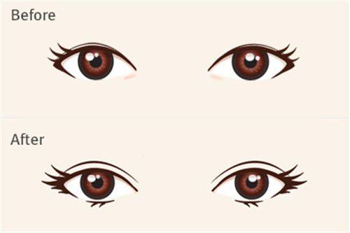 东莞南城环球美天元美医疗美容诊所真人口碑评价怎么样？