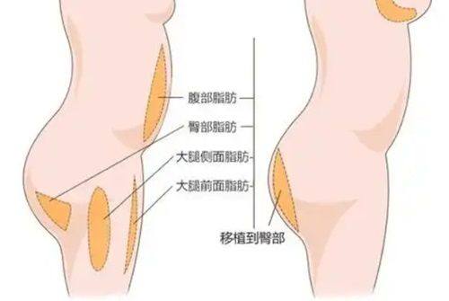 扬中曼陀罗医疗美容诊所特色项目及技术优势