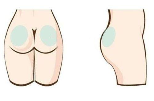 扬中曼陀罗医疗美容诊所真人口碑评价怎么样？