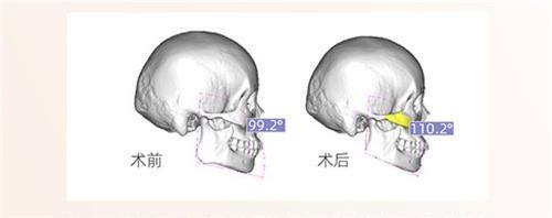广州佐登医学美容特色项目及技术优势