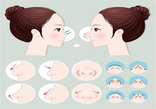 广州佐登医学美容医生团队实力强大及骨干医生简介