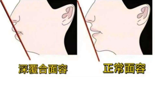 深圳格伦菲尔口腔南山分院真人口碑评价怎么样?