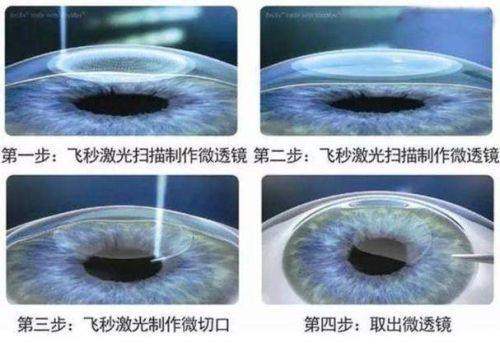 广东省中医和西医结合医院眼科详细的预约挂号方式及流程