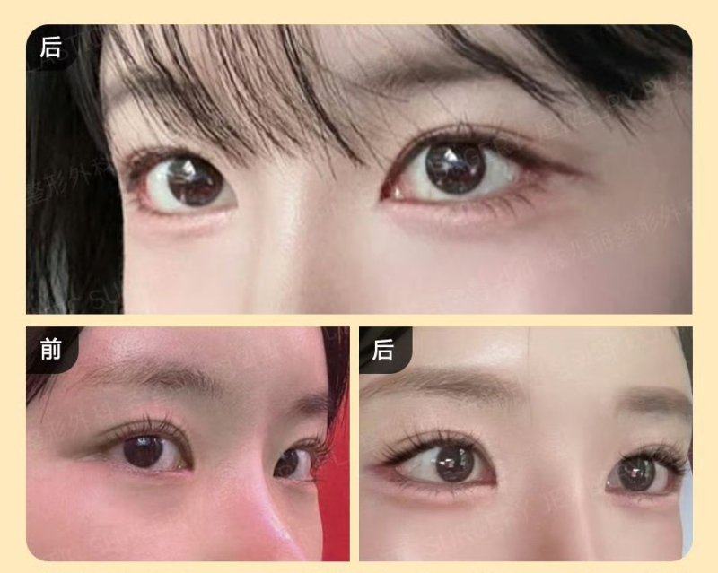 常熟时代医疗美容医院是正规医院吗?