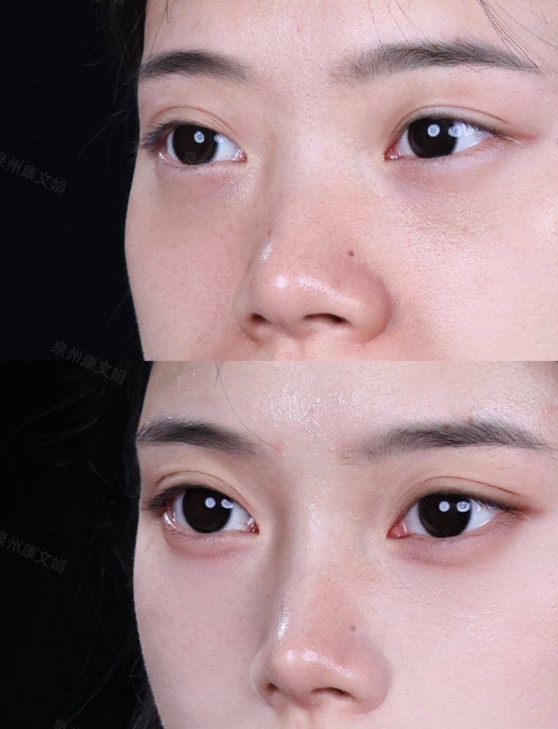 广州佐登医学美容真人口碑评价怎么样?