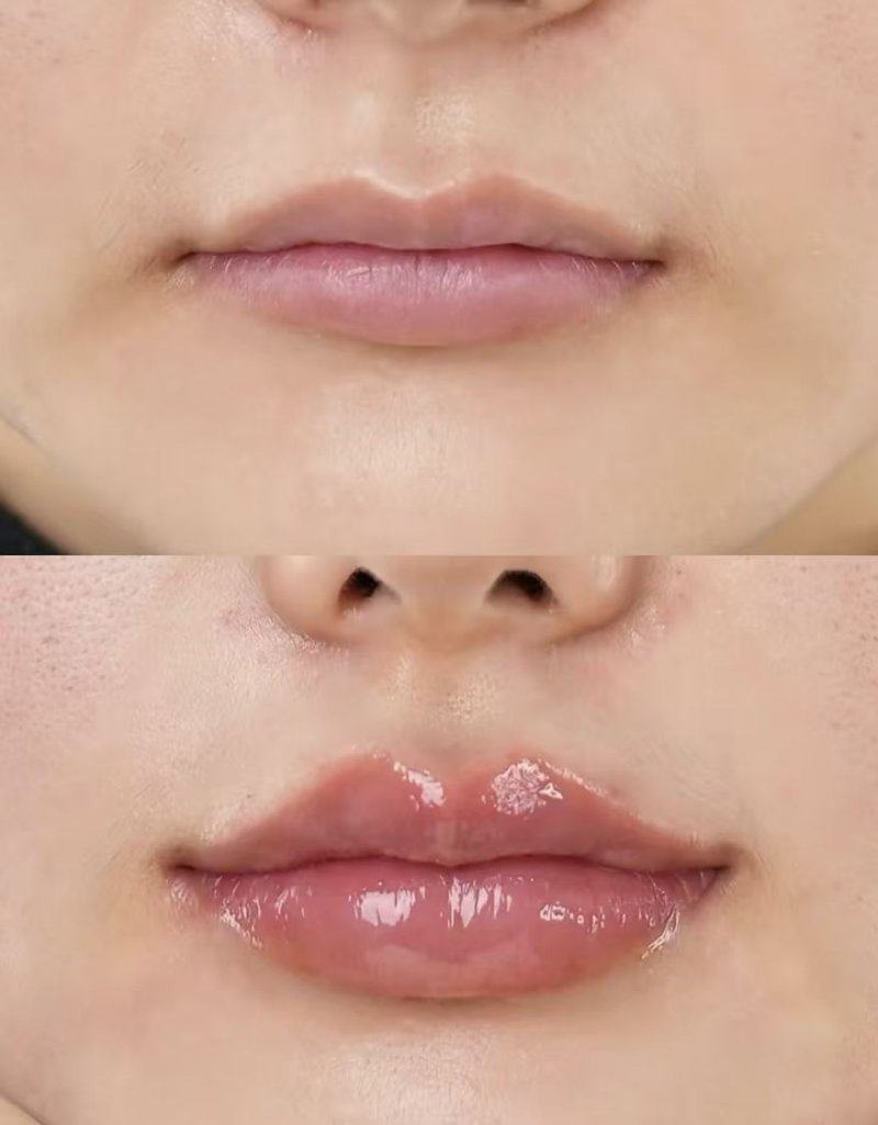 东莞南城环球美天元美医疗美容诊所详细的预约挂号方式及流程