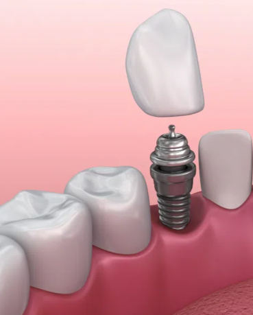 九江市第一人民医院活水院区口腔科收费价格表/收费标准