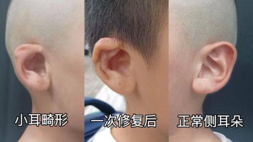 南京恒丽医学整形美容中 心特色项目及技术优势