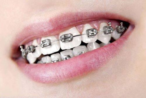 德维口腔医院真人口碑评价怎么样？