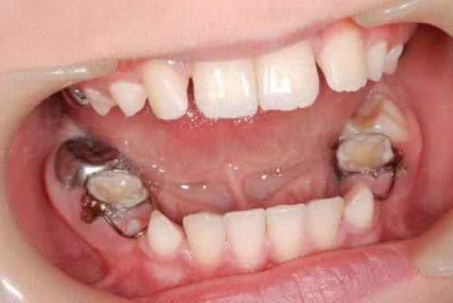 武侯真爱口腔门诊部收费价格表/收费标准