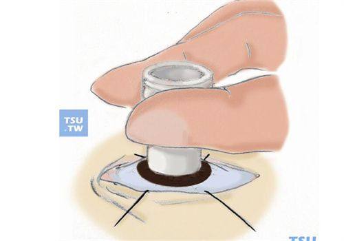 安阳市眼科医院地址电话营业时间