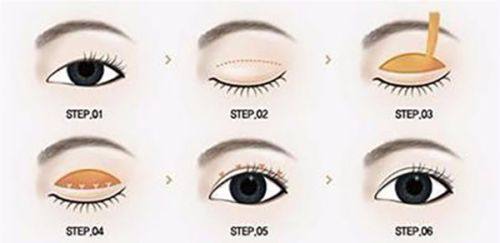 郑州一美整形美容门诊部收费价格表/收费标准