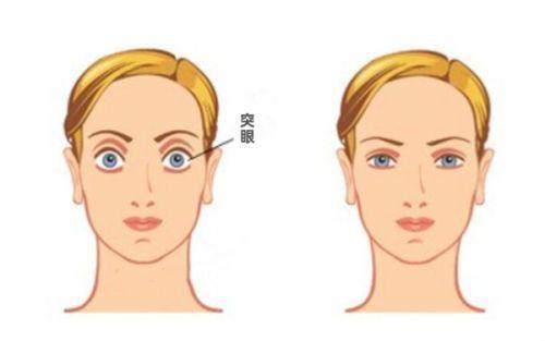 深圳市儿童医院眼科收费价格表/收费标准