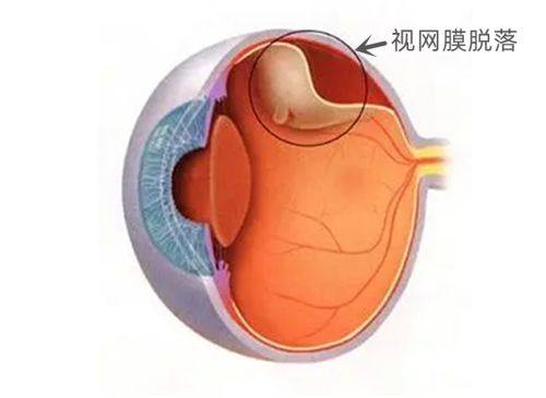 深圳市儿童医院眼科真人口碑评价怎么样?