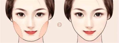 上海香格丽雅医疗美容门诊部真人口碑评价怎么样?