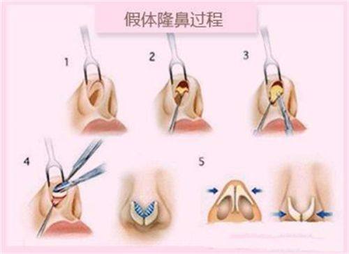 南宁申美芯医疗美容诊所是正规医院吗?