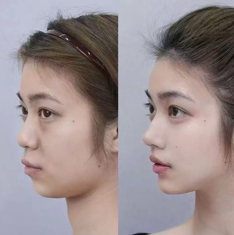 南京恒丽医学整形美容中 心收费价格表/收费标准