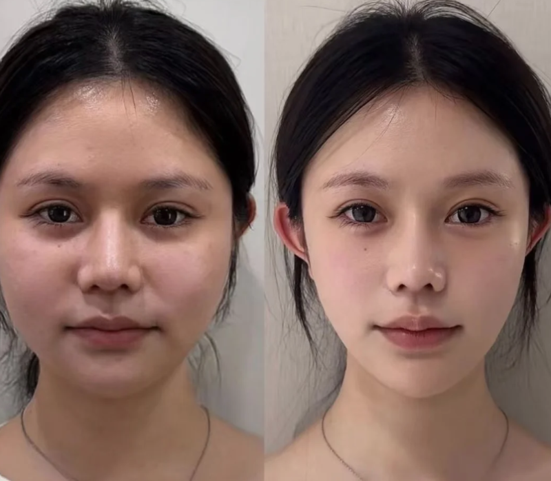 上海香格丽雅医疗美容门诊部特色项目及技术优势