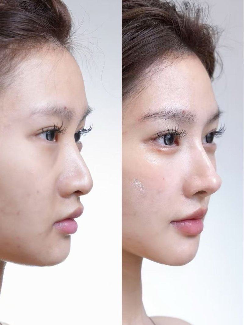 南宁申美芯医疗美容诊所特色项目及技术优势