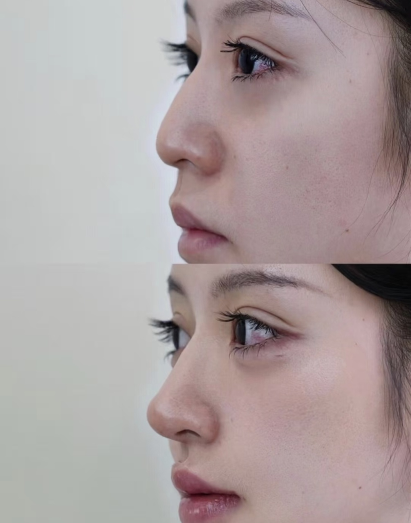 南京恒丽医学整形美容中 心详细的预约挂号方式及流程