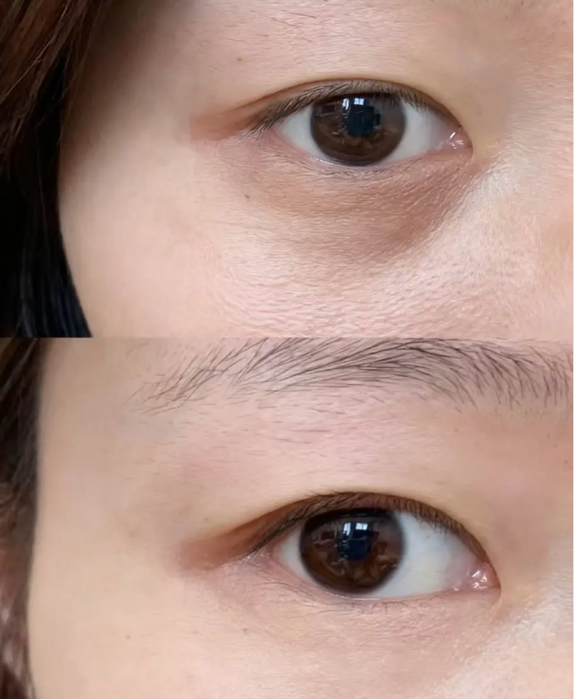 重庆ES时尚整形美容门诊部真人口碑评价怎么样？