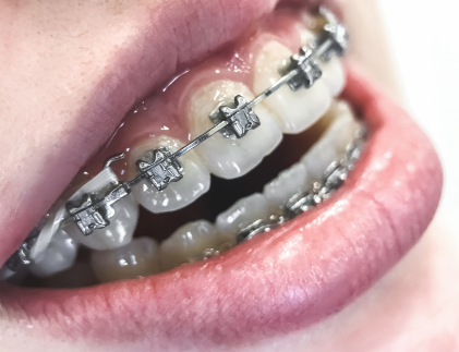 德维口腔医院详细的预约挂号方式及流程