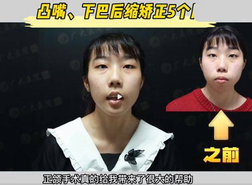 韩国A特整形外科医院详细的预约挂号方式及流程