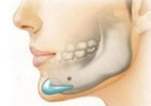 南京千秀美珏整形美容医院特色项目及技术优势