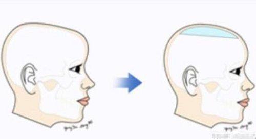 成都华 西整形医院特色项目及技术优势