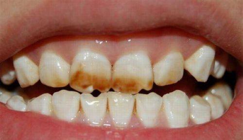 广州侨城侨南口腔门诊部真人口碑评价怎么样？