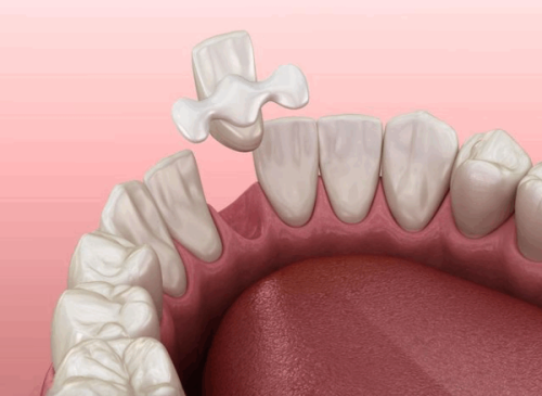 河南周口德正口腔医院详细的预约挂号方式及流程