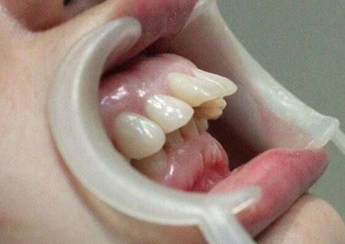 山东淄博淄川将军路孙岳口腔诊所是正规医院吗？