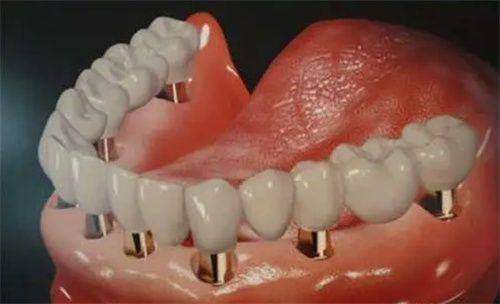 海口海歌口腔门诊部收费价格表/收费标准