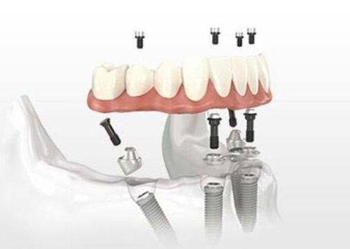 海口海歌口腔门诊部真人口碑评价怎么样？