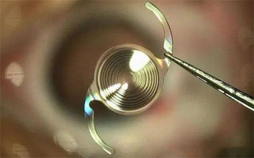 桓台县妇幼保健院眼科是正规医院吗?