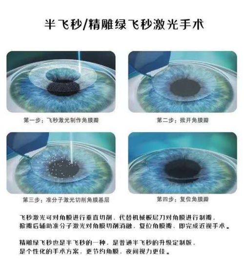 鄂尔多斯旭永眼科医院医生团队实力强大及骨干医生简介