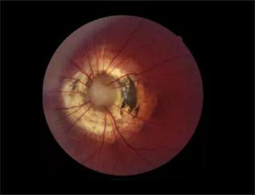 鄂尔多斯旭永眼科医院详细的预约挂号方式及流程