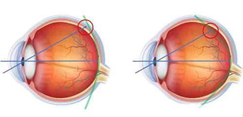 江苏兴化萌鹰眼科诊所详细的预约挂号方式及流程